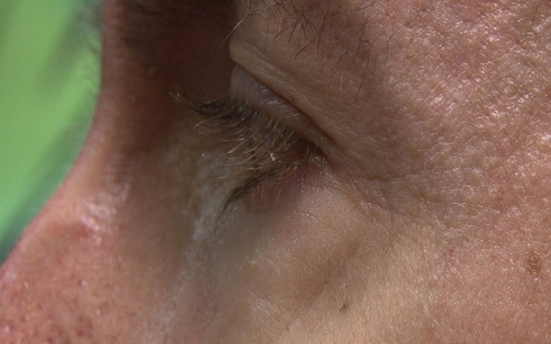 EyeTech eye