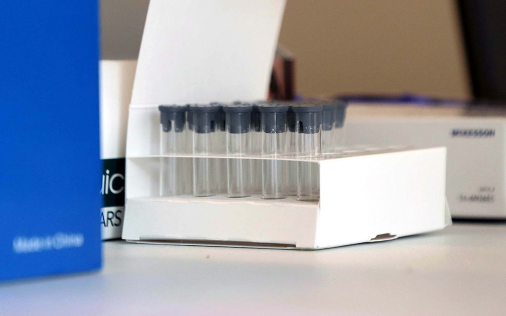Sample tubes for COVID-19 testing are lined up at a Foundation for Senior Living facility in Phoenix on March 1, 2023. (Photo by Paula Soria/Cronkite News)